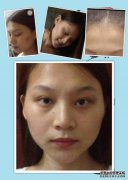 1岁大的婴儿舔了舔骨头，头部有点bump